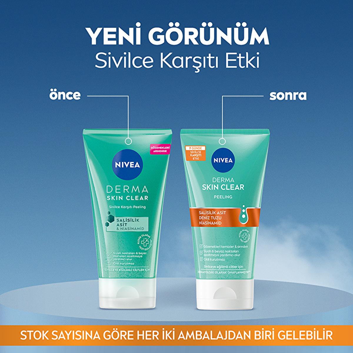 Nivea Derma Skin Clear Acne Fighting Face Peeling - Deep Cleansing, Exfoliant for Acne Prone Skin - Glamourous Grace