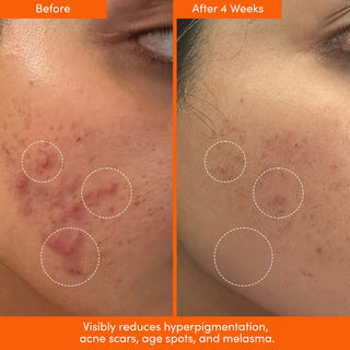 THE PLACENTA FACIAL Dark Spot Serum + Barrier Repair Cream Bundle