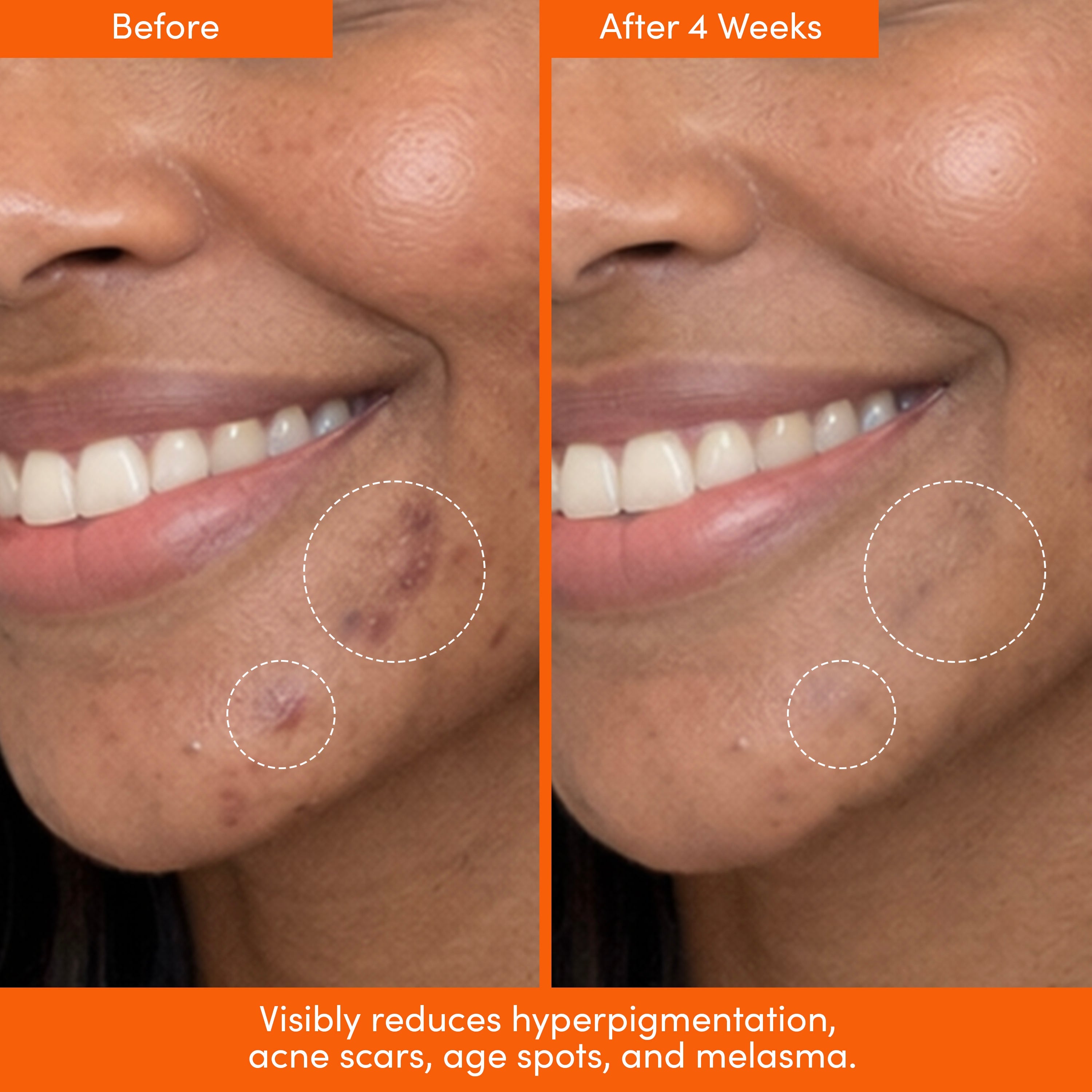 UNSPOTTED 4X® Acid Jelly Night Serum