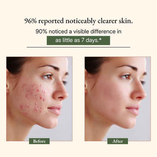 Ayurvedic Neem Soap Bar