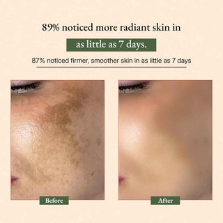 Anti-Aging Serum Gift Set