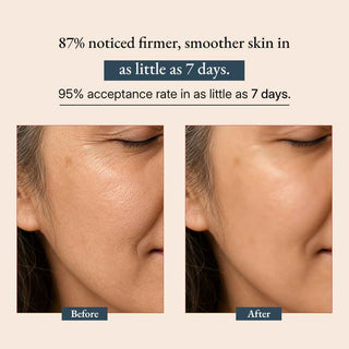 Supercharge Bakuchiol Retinol Serum