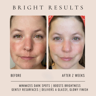 Vitamin C Glow Drops (Collective)