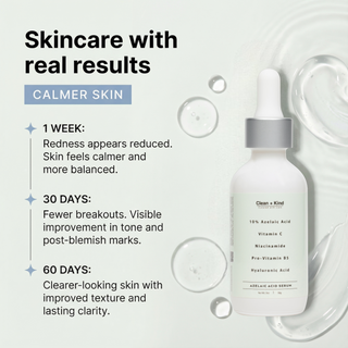 Azelaic Acid Serum 10% — Silicone-Free, Fragrance-Free, 2 oz
