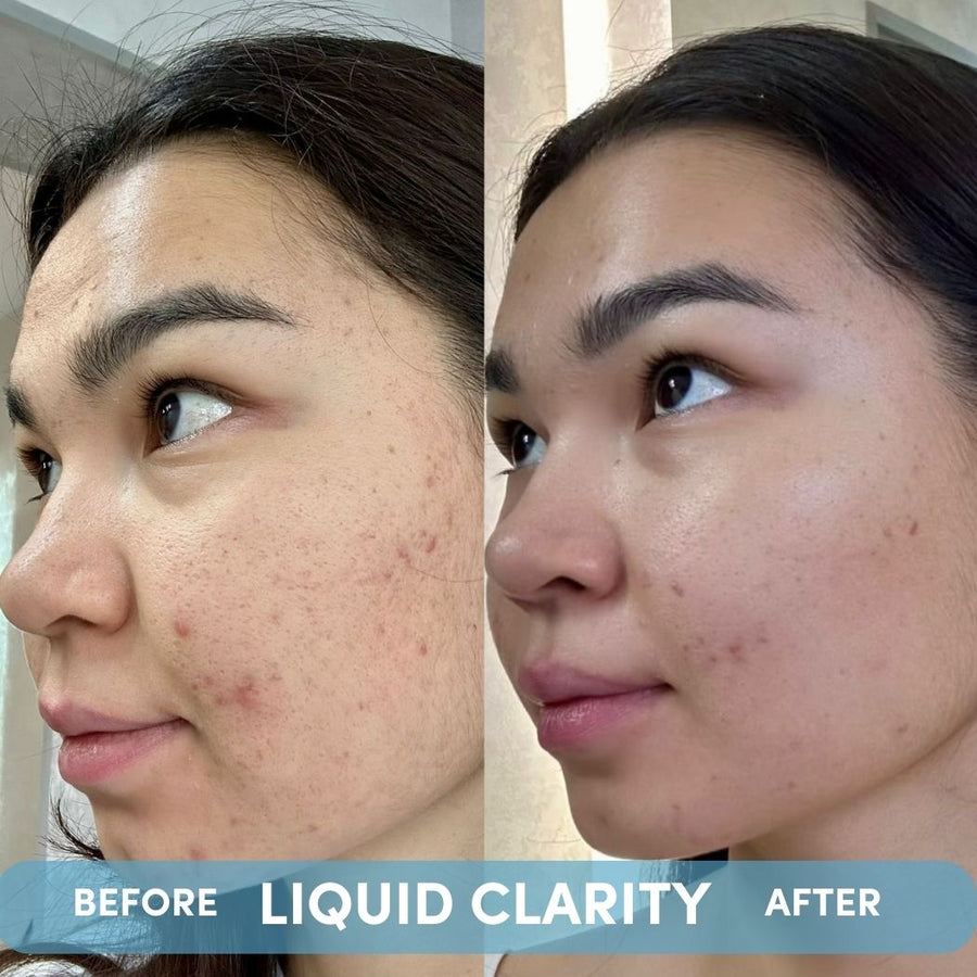 LIQUID CLARITY