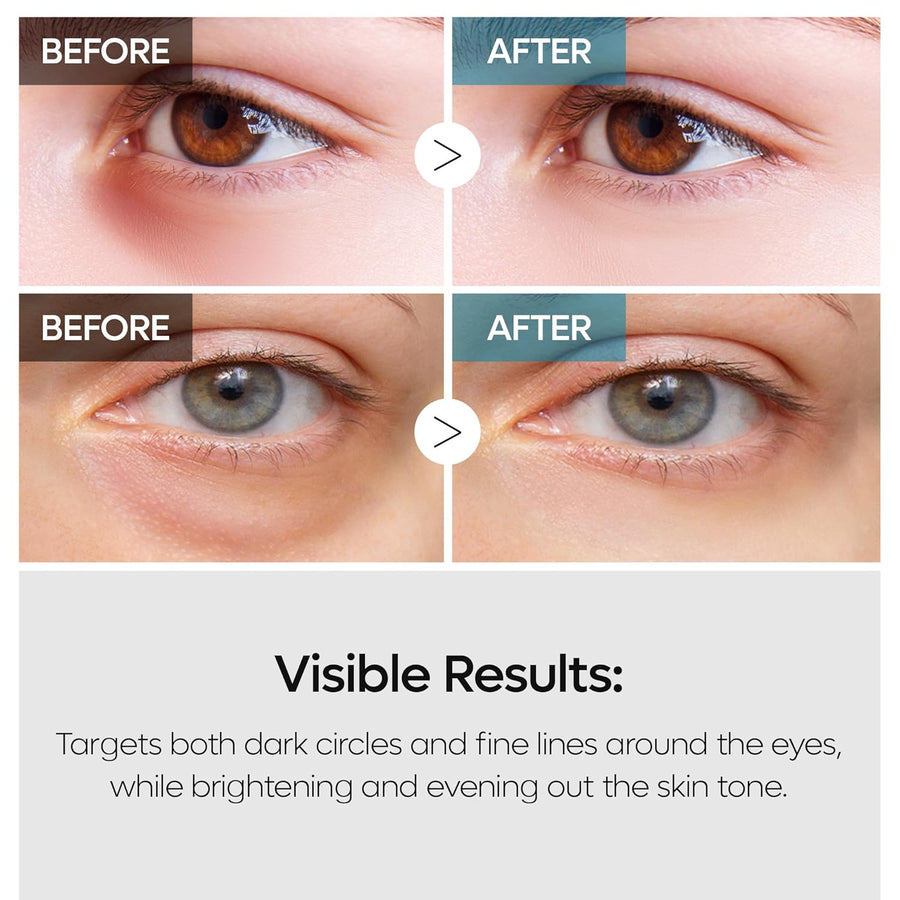 Dr. Melaxin TX Retinalsome Double Effect Eye Cream - Glamourous Grace