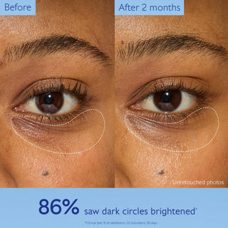 Caudalie Vinoperfect Brightening Eye Cream - Dark Circle Treatment & Anti-aging Eye Care - Glamourous Grace