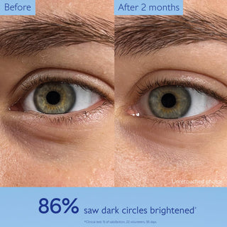 Caudalie Vinoperfect Brightening Eye Cream - Dark Circle Treatment & Anti-aging Eye Care - Glamourous Grace