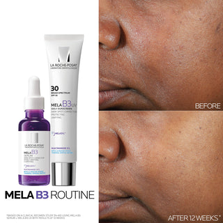 La Roche Posay Anti-Dark Spot Serum Mela B3 10 - 30ml, Dermatologically Tested Skincare for Hyperpigmentation Treatment - Glamourous Grace