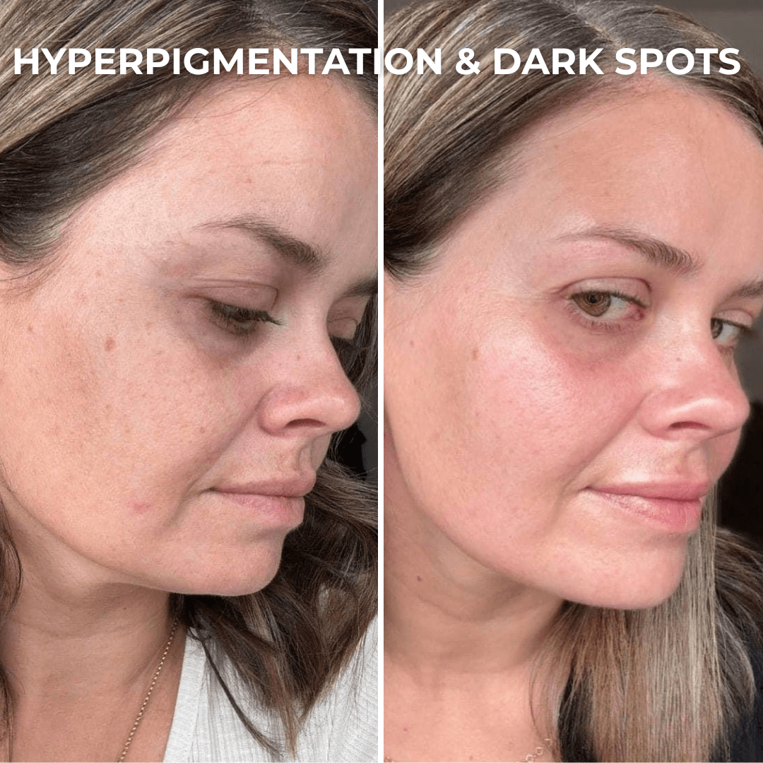 PDRN Collagen Peptide Hydrogel Mask