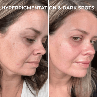 PDRN Collagen Peptide Hydrogel Mask
