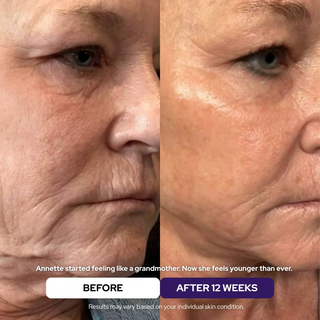 Hydrolyzed Collagen Age Defying Mask - 2.54 fl.oz