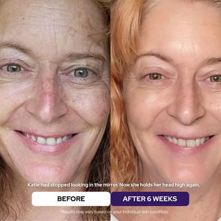 Hydrolyzed Collagen Age Defying Mask - 2.54 fl.oz
