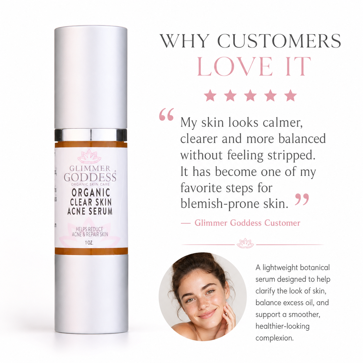 Organic Acne Serum – Oil Control & Pore Clearing Treatment - Glamourous Grace