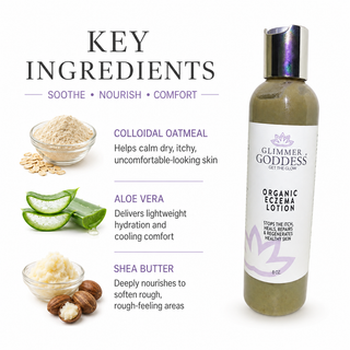 Organic Eczema Lotion – Soothing Relief & Skin Healing - Glamourous Grace