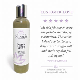 Organic Eczema Lotion – Soothing Relief & Skin Healing - Glamourous Grace