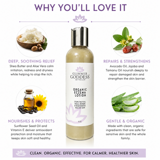 Organic Eczema Lotion – Soothing Relief & Skin Healing - Glamourous Grace