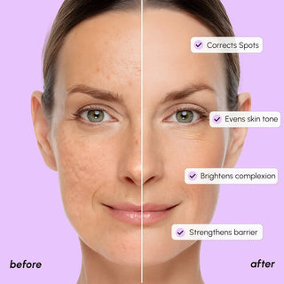 Dark Spot Corrector - Glamourous Grace
