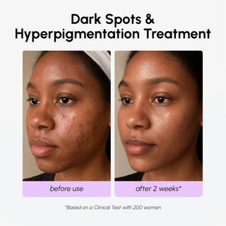 Dark Spot Corrector - Glamourous Grace