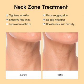 Lifting Neck Wrinkle Patches - Glamourous Grace