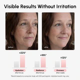 Firming & Renewing PDRN Serum - Glamourous Grace
