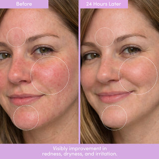 THIRST TRAP Barrier Repair Cream + SPF Ultra-Hydration Bundle