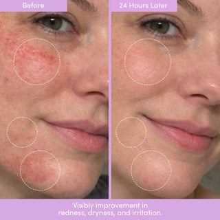 PEP TALK™ Bio-Peptide Barrier Repair Cream with Triple Lipid Complex