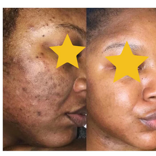 Skin Revive Lightening Cream