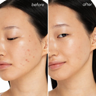 Witch Hazel Clearing Pads - Glamourous Grace