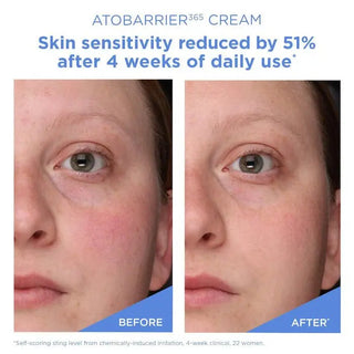 AESTURA Atobarrier365 Cream