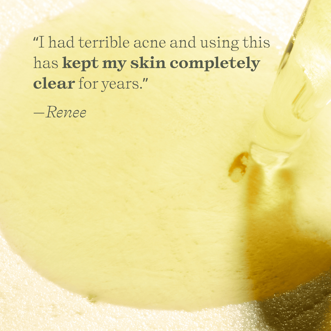 Green Tea Clarifying Facial Oil (Formerly Herbal Facial Oil)