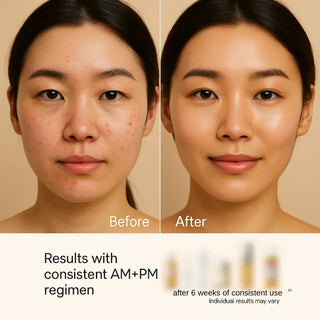 Full-Size Korean Skincare Set for Dark Spots, Fine Lines & Glass Skin