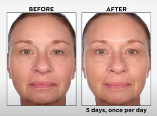 Black Rice 5-Day Brightening Serum