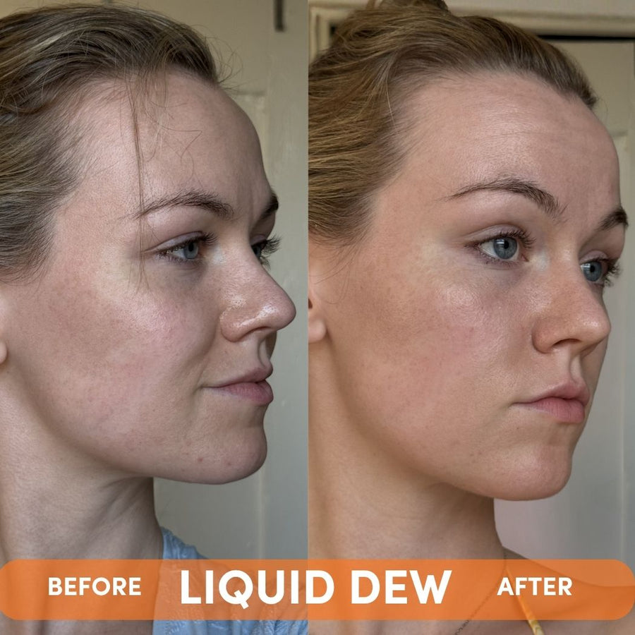 LIQUID DEW
