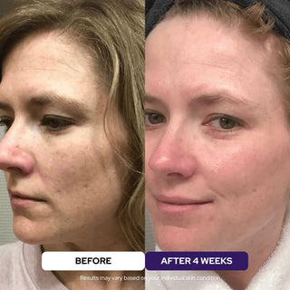 Elixir Serum - 24k Gold Ceramides Niacinamide Vitamin C