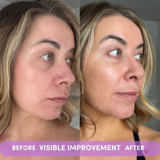 VISIBLE IMPROVEMENT