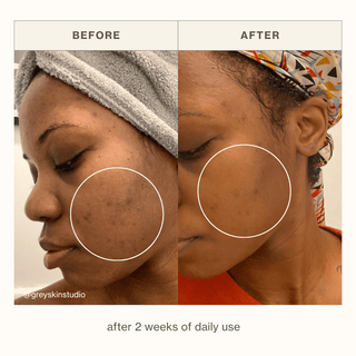 Neroli Clarifying Complexion Mist