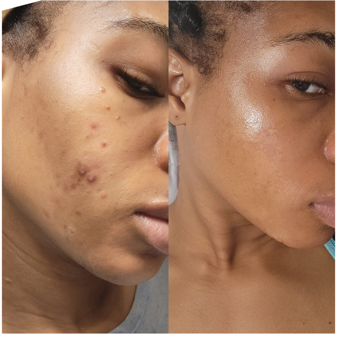 Skin Revive Lightening Cream