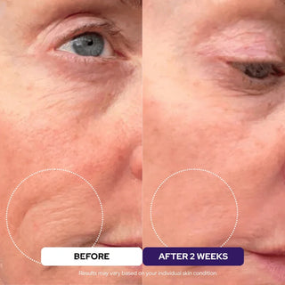 Plumping Serum - Peptides PDRN Niacinamide Retinol
