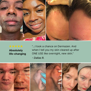 Peaceful Skin System