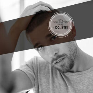 Bioxcin Anti Hair Loss Shampoo for Dry/Normal Hair - 10.14 fl oz, Herbal, pH Balanced, Clinically Tested - Glamourous Grace