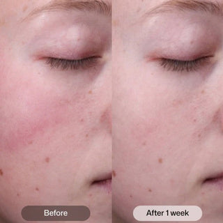 Revision Skincare Radiance+ Resurfacing Serum