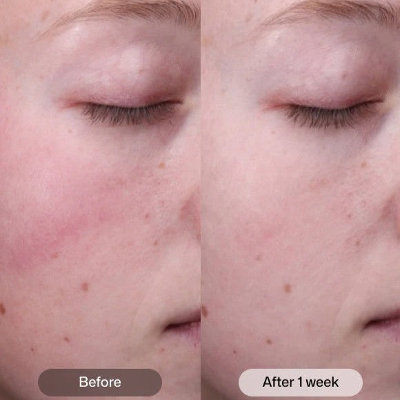 Revision Skincare Radiance+ Resurfacing Serum - Glamourous Grace