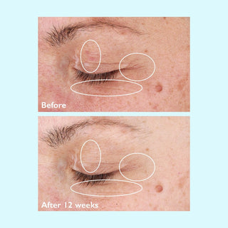 Restorsea PRO Firming Eye Serum