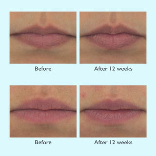 Restorsea PRO Lip Magic