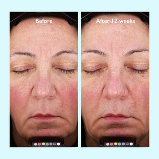 Restorsea PRO Rebalancing Lotion