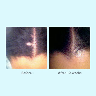 Restorsea PRO Revitalizing Scalp Treatment